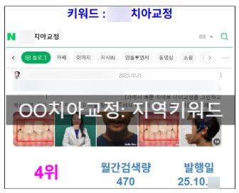 고객 정보 보호를 위해 모자이크 처리한 치과블로그 대행 문의 내용