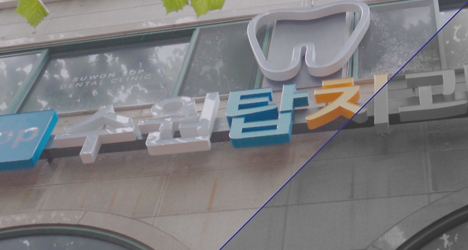 실제 환자 사례를 담은 병원 홍보영상 장면
